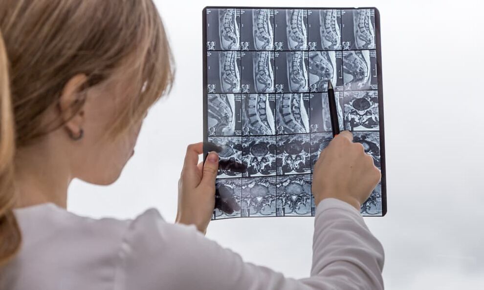 Magnetic resonance imaging helps the doctor identify osteochondrosis and prescribe treatment