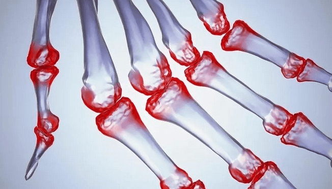 Pain in the fingers joints