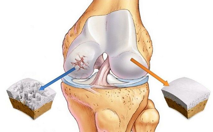 Healthy and articulate joints